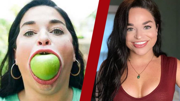 Woman scores Guinness World Record for her Gigantic Mouth